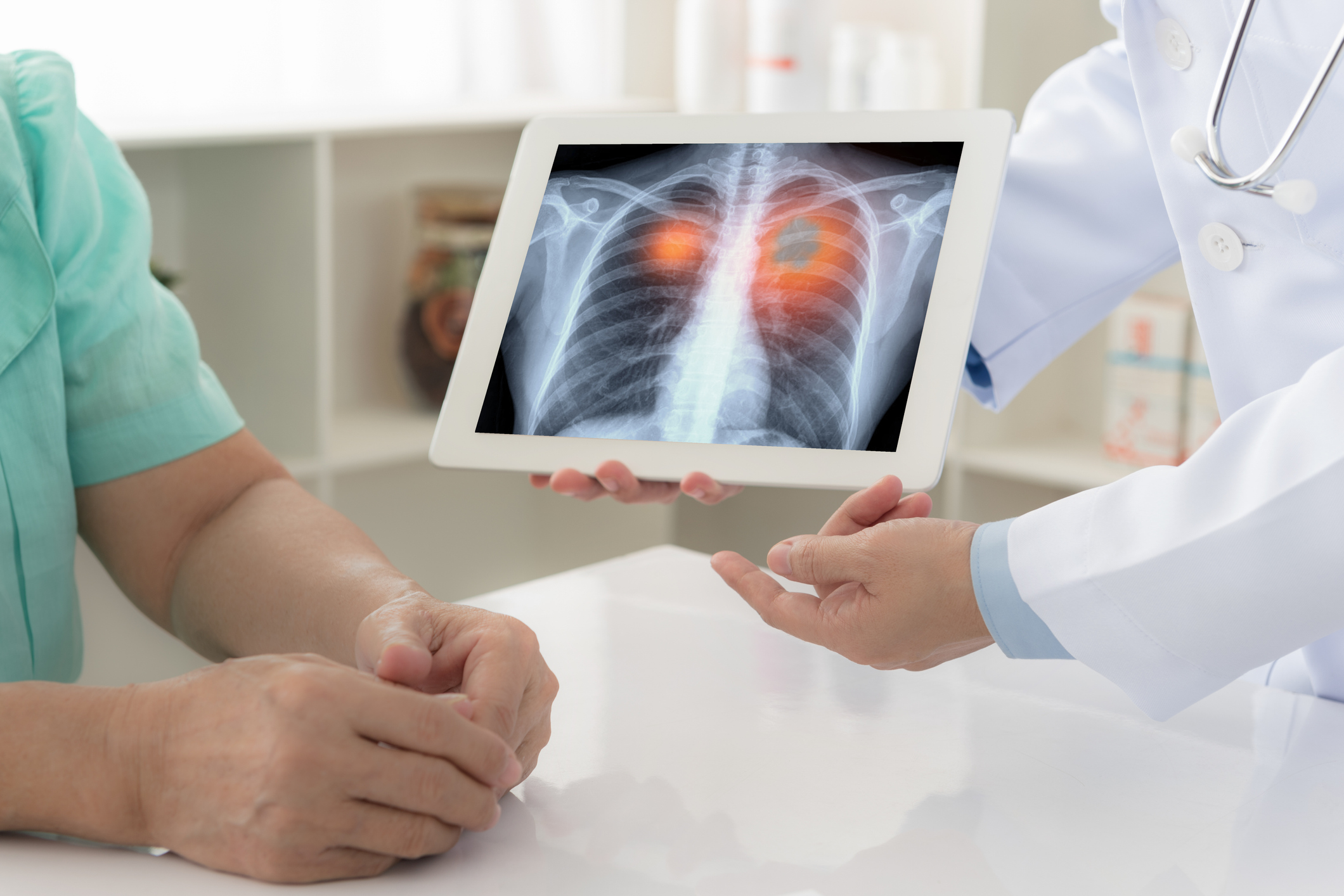 High Risk Lung Cancer Screening Age Lowered The Oldish