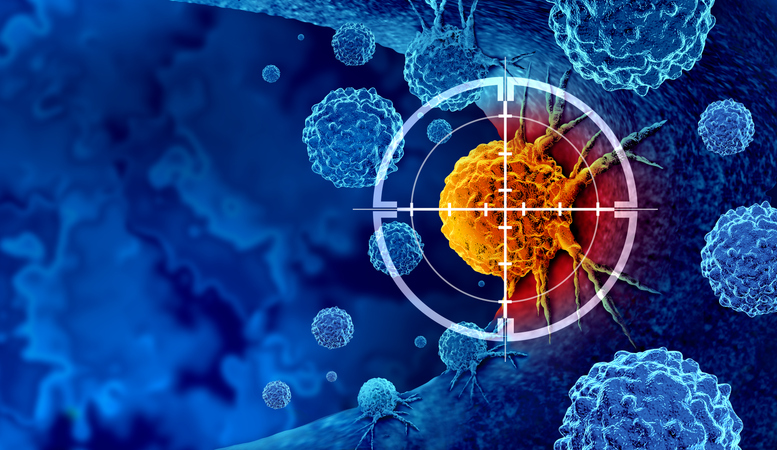 Cancer detection screening image